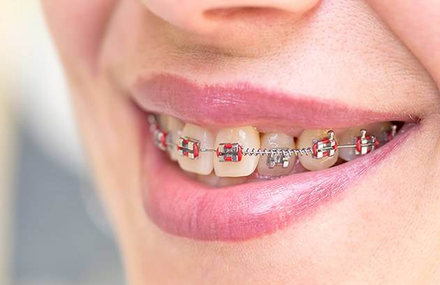 orthodontics clinic oman